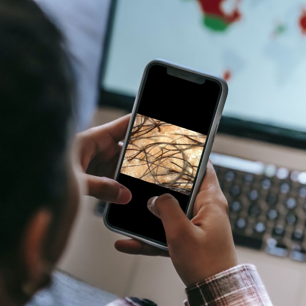 Is Folliculitis Related to Hair Loss?