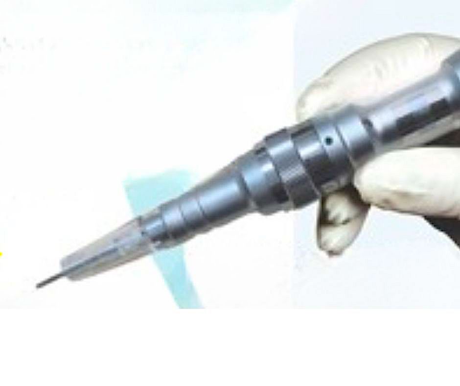 Does Microneedling Work for hair loss?